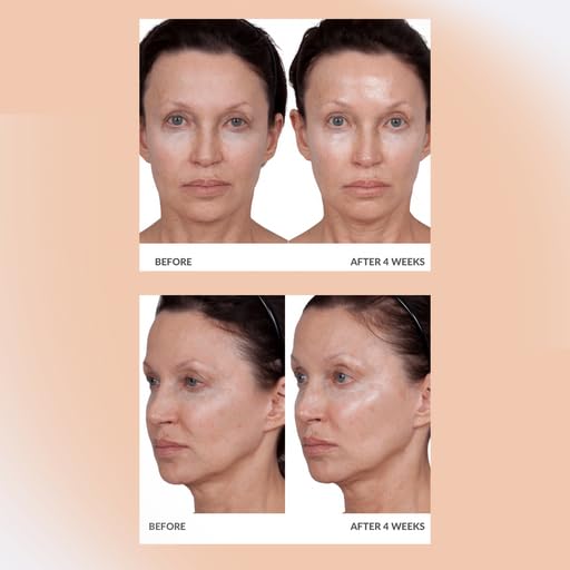 Consult Beaute Volumagen - Collagen Facial Serum Concentrate for Nourishing &amp Plumping Skin - Hydrates and Temporarily Fills for Smoother Bouncy Skin - Hyaluronic Acid &amp Vitamin C - 2 Fl. Oz.