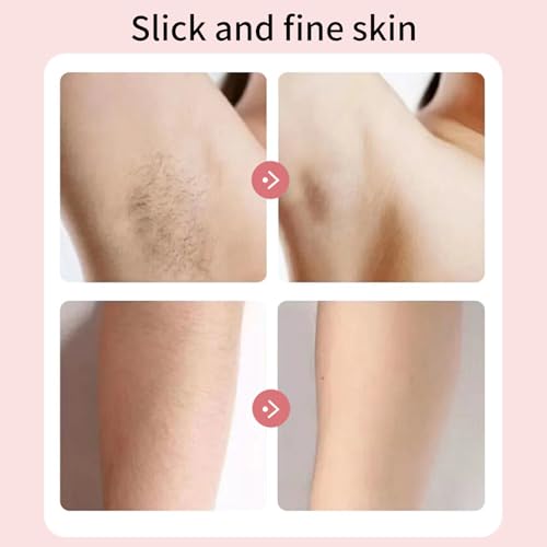 Electric Lady Epilator 2 Removable Washable Heads Cordless Rechargeable Hair Removal Device 6.5 inches