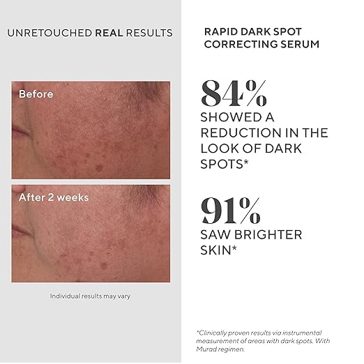 Murad Rapid Dark Spot Correcting Serum - Advanced Anti-Aging Formula with Patented Resorcinol Technology Tranexamic and Glycolic Acids for Hyperpigmentation Dark Spots and Dull Skin - 1 Fl Oz