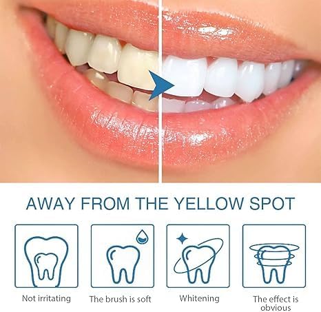 Teeth Paint2025 Best Tooth PaintNatural Teeth Whitening PaintPortable Tooth Polish Uptight White