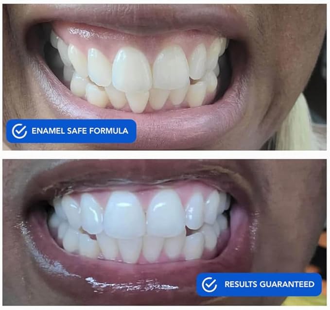 Snow DiamondSeries??Whitening Strips 14 CT