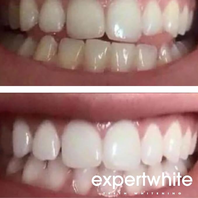Ultra+ 44% Teeth Whitening Gel Refills for Trays. Carbamide Peroxide Strongest Dental Tooth Bleaching Syringe for Brite Teeth Smile (4 gels 3cc Each 15 Minutes). Gels only. No Trays.