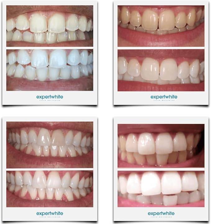 Ultra+ 44% Teeth Whitening Gel Refills for Trays. Carbamide Peroxide Strongest Dental Tooth Bleaching Syringe for Brite Teeth Smile (4 gels 3cc Each 15 Minutes). Gels only. No Trays.