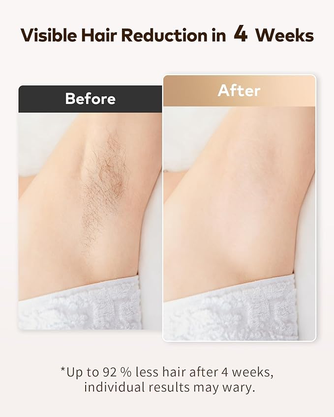 LYSMOSKI IPL Laser Hair Removal At Home Hair Removal for Women and Men Laser Hair Removal Device Pain-Free System for Lasting Hair Reduction on Face Armpits Bikini Area
