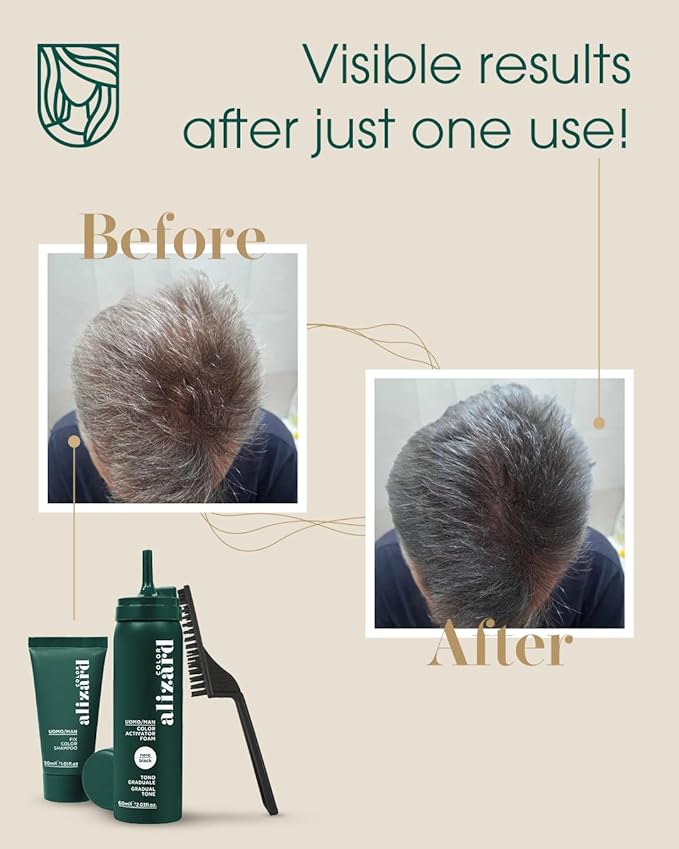 Alizard Natural Hair Color for Gray Hair | Gradual De-Graying Shampoo | Hydrolyzed Collagen &amp Allatonin | Not Hair Dye - Color Activation | Grey Hair Touch Up | Men &amp Women | Instant Results -