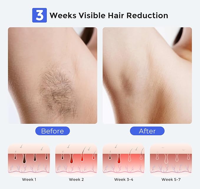 LUBEX Smart Permanent IPL Laser Hair Removal for Woman and Men Painless Sapphire Ice-Cooling Alternative to Salon Bikini Shaver Facial Epilator for Armpits Back Legs Arms Face Bikini Glow 6 A+