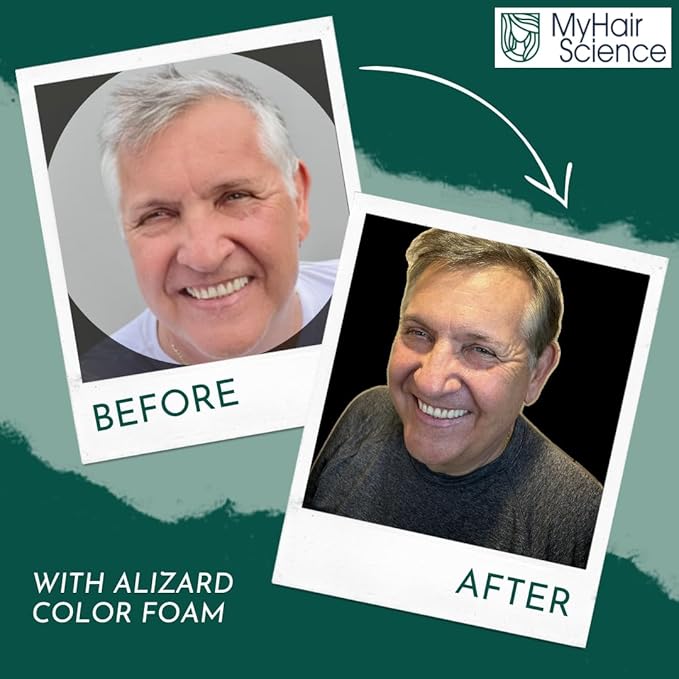 Alizard Natural Hair Color for Gray Hair | Gradual De-Graying Shampoo | Hydrolyzed Collagen &amp Allatonin | Not Hair Dye - Color Activation | Grey Hair Touch Up | Men &amp Women | Instant Results -