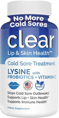Lysine Cold Sore Treatment for Lips with Pre-Probiotics &amp VIT C | 1 Month Supply | Supercharged Lysine Capsules with Rhamnosus &amp Acidophilus for Cold Sores Relief Skin + Gut Health &amp Immu