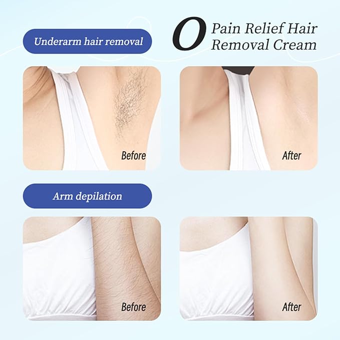 Hair Removal Cream for WomenSensitive Depilatory Cream for Bikini8 Minute Fast and Pain free Acting Depilatory for Legsand Underarms - Gentle Formula for All Skin Type10.59oz