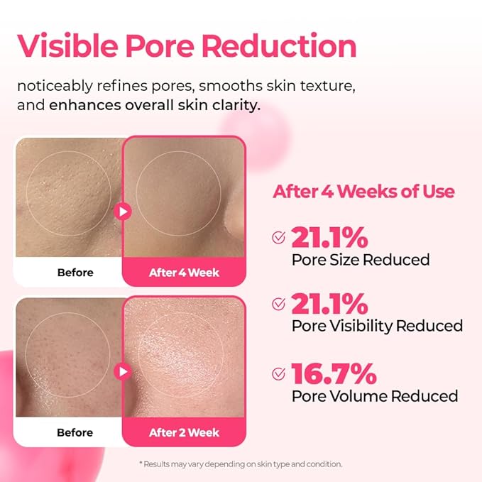 Dr.Melaxin Cemenrete Cyano Pink Spicule Serum with Calcium korean skin care pore tightening refines spicule microneedling serum 1.01 fl. oz.
