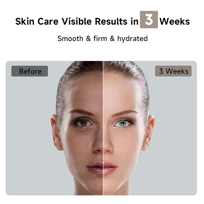 JOVS Laser Hair Removal 37°F Painless Hair Removal Device with Sapphire Ice-Cooling 3 in 1 Hair Removal &amp Skin Rejuvenation for Women and Men 8 Modes Skin Care for Whole Body Touch Screen