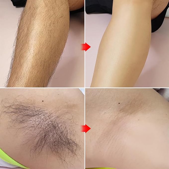 Touch-Up Painless Hair Removal Gel for Bikini Area - All Skin Types Treatment for Women &amp Men 150ml