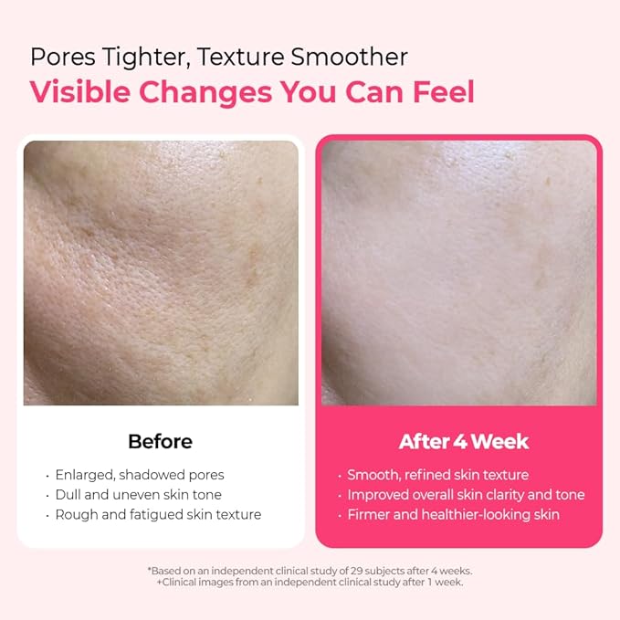 Dr.Melaxin Cemenrete Cyano Pink Spicule Serum with Calcium korean skin care pore tightening refines spicule microneedling serum 1.01 fl. oz.