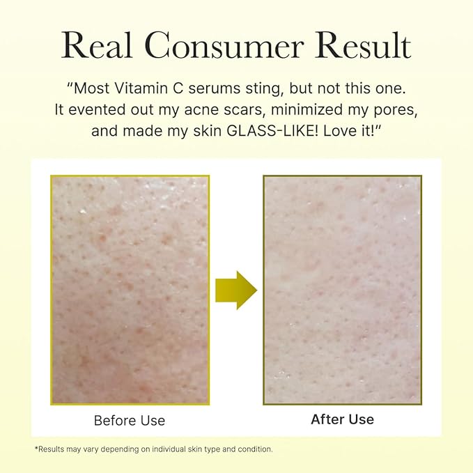 Arencia Vitamin C Booster Serum with Glutathione Niacinamide and Vitamin E for Glow Skin 1.01 fl oz
