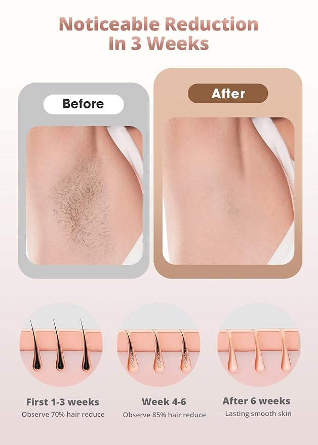 LYSMOSKI Laser Hair Removal 10-Mins Full Body IPL Hair Removal At-Home Hair Remover Device for Armpits Back Legs Arms Face Bikini Line