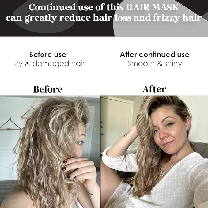 Biotin and Hydrolyzed Collagen Hair Mask for Dry &amp Damaged Hair with Aloe Vera Avocado Oil Vitamin E Oil (8oz)
