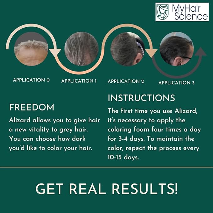 Alizard Natural Hair Color for Gray Hair | Gradual De-Graying Shampoo | Hydrolyzed Collagen &amp Allatonin | Not Hair Dye - Color Activation | Grey Hair Touch Up | Men &amp Women | Instant Results -