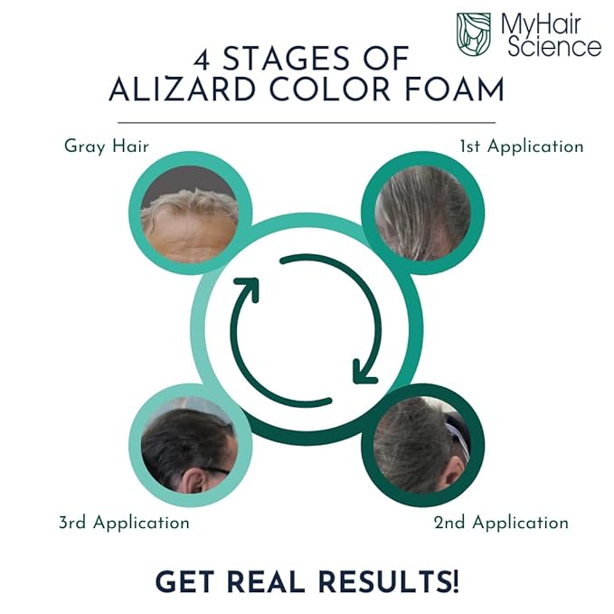 Alizard Natural Hair Color for Gray Hair | Gradual De-Graying Shampoo | Hydrolyzed Collagen &amp Allatonin | Not Hair Dye - Color Activation | Grey Hair Touch Up | Men &amp Women | Instant Results -