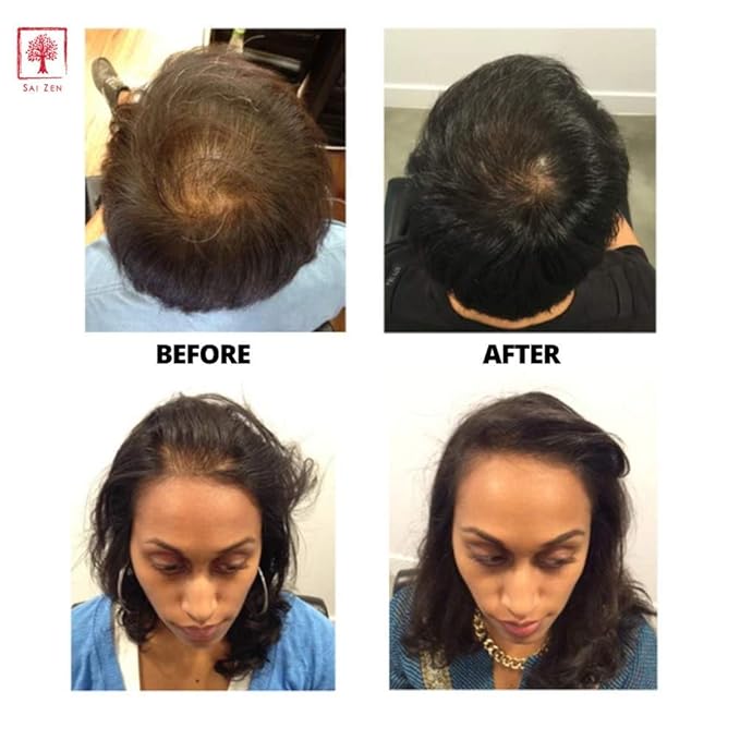 Volume Plus Scalp Therapy Spray | Post-Shower Hair Strengthening Formula | Made in USA |Alcohol and Paraben Free 4 oz.