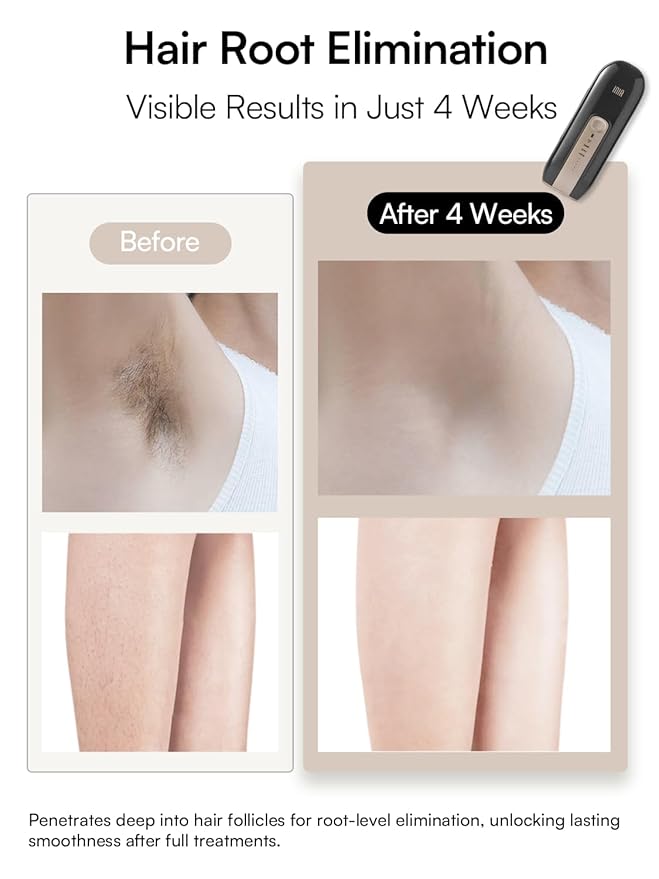 Laser Hair Removal Device for Women and Men INIA Fond Hair Remover with Long-Lasting in Hair Reduction for Body&ampFace Safe at-home Results for Armpits Bikini and Legs