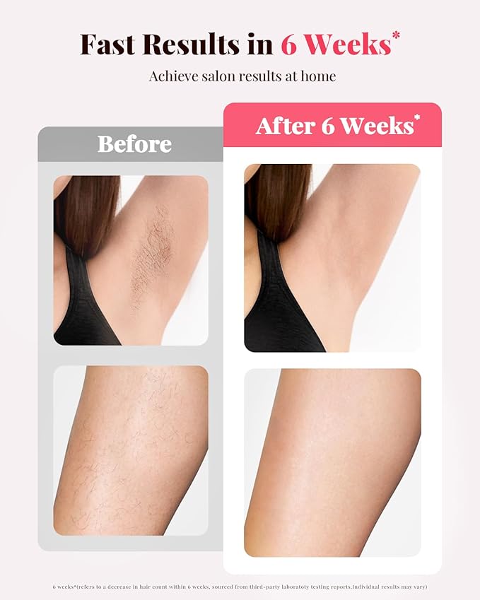 IPL Laser Hair Removal Device for Women &amp Men - at-Home Painless Hair Remover for Long-Lasting Results Body &amp Face for 85% Hair Reduction in 3 WeeksPink