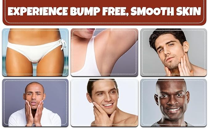 BUMP Terminator Fast Acting Alcohol BASED Water Free Anti Razor Bumps Ingrown Hair Skin Treatment for Face Neck Bikini Area Legs &amp Back Of Head Bumps Remover Unisex Lotion 5.4 fl oz