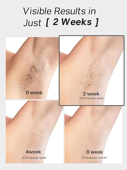 Blex Laser Hair Removal for Women and Men IPL Hair Removal Device Effective in 2 Weeks with Ultra-Fast 0.2s Light Emission Comfortable and Painless Black