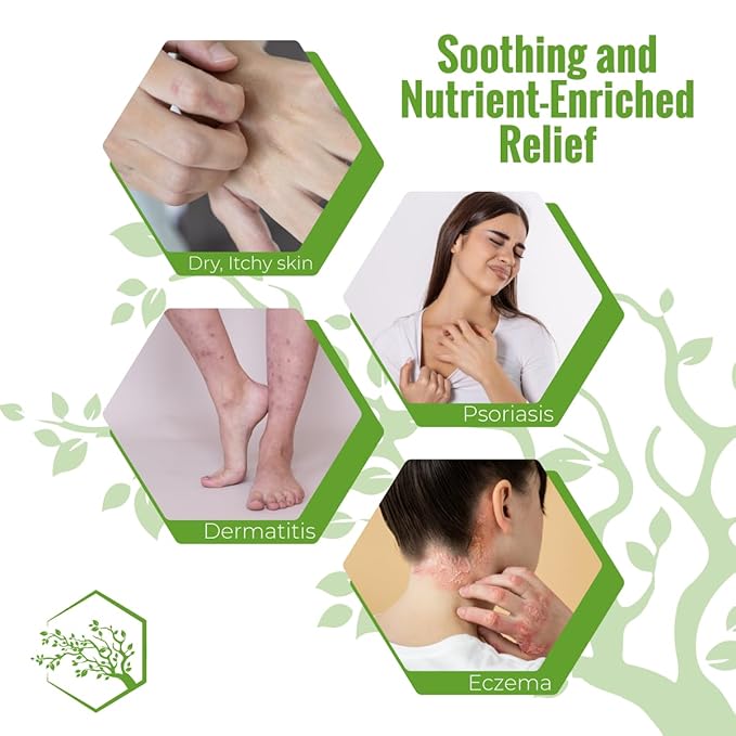 Moisturizing Eczema Body Wash ? Gentle Psoriasis Body Wash for Itchy Dry Skin Relief ? Eczema Soap for Redness and Flareups ? Hydrating Cleanser for Women and Men