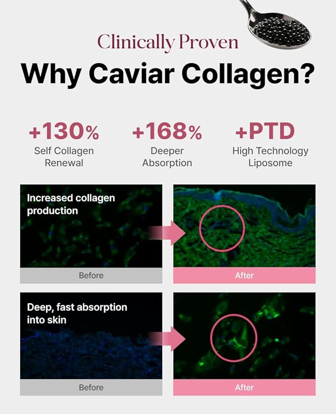 Delere Caviar AHA 3% Glow Toner | Korean Collagen Exfoliating Toner | Korean Exfoliator for Radiance Collagen Skin Care 250ml