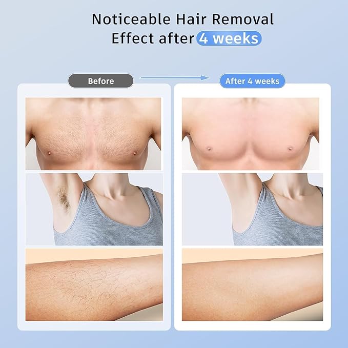 Laser Hair Removal with 5??Ice Cooling Painless IPL Laser Hair Removal Device 3 in 1 Ubroo at Home Hair Remover Machine for Women Men Electrolysis Permanent Epilator on Face Body Depilation (Purple)