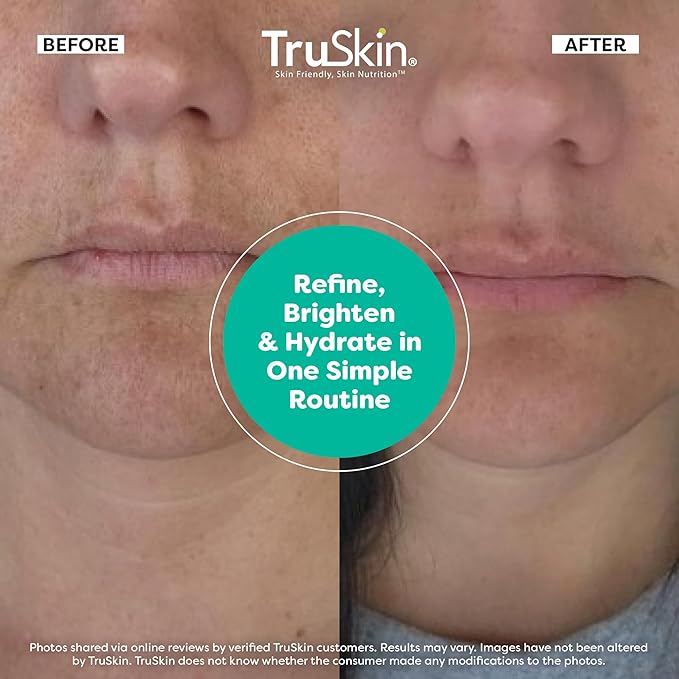 TruSkin Face Serum Trio ? Hyaluronic Acid Vitamin C &amp Retinol Serum for Face ? Anti Aging Skin Care Set for Women ? Skincare for Bright Smooth Hydrated &amp Firmer-Looking Skin 1 fl oz 3 Bot