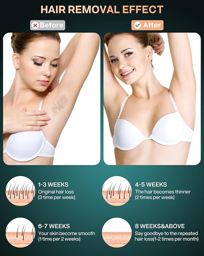 Laser Hair Removal for Women Permanent999999 Flashes Painless IPL Hair Remover with Ice Cooling Care Function at Home Hair Removal Device for Facial Armpits Legs Bikini Line Whole Body Corded