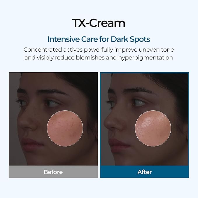 DR.Melaxin TX Tranexamic Acid CREAM | Skin freckle Cream Blemishes Anti-pigmetation korean skin care | Korean Cosmetics | 1.7 fl oz (50 ml)