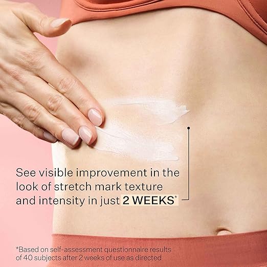 StriVectin SD Advanced Plus Intensive Moisturizer for Wrinkles and Stretchmarks For Face and Body Collagen Boosting with Peptides and Hyaluronic Acid