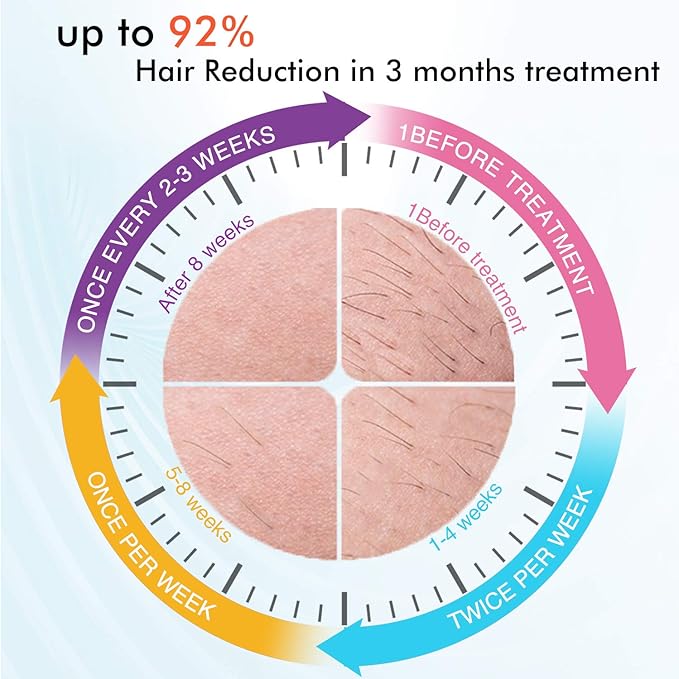 IMENE Permanent Hair Removal Machine for Women &amp Men 500000 Flashes IPL System with Ice Care Function for Full Body Home Use - Safest and Fastest IPL Technology