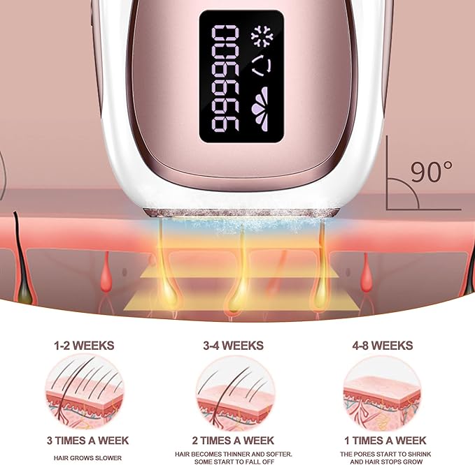 Laser Hair Removal for Women and Men (Gold)