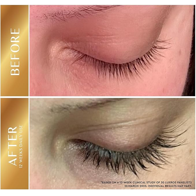 Eyelash Growth Serum 5 mL: Get Thick Strong Lashes in Just 3-4 Weeks with Our Plant-Based Eyelash Growth Serum - No Parabens - Made in USA