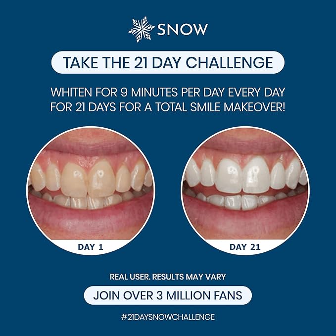 Snow Teeth Whitening Kit - Snow Teeth Whitening Serum and LED Mouthpiece Whitener Formulated with Hydroxyapatite Good for 6 Months - Wired Kit with 3 Wands