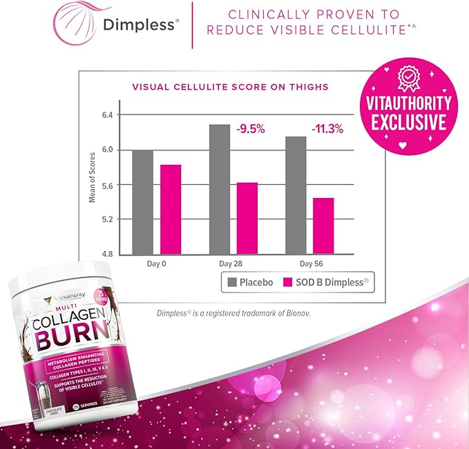 Vitauthority Collagen Peptides Powder Weight Loss Supplements | Hydrolyzed Beauty Complex for Women Hair Skin Nails | Fat Burning Support | Chocolate Flavored 25 Servings