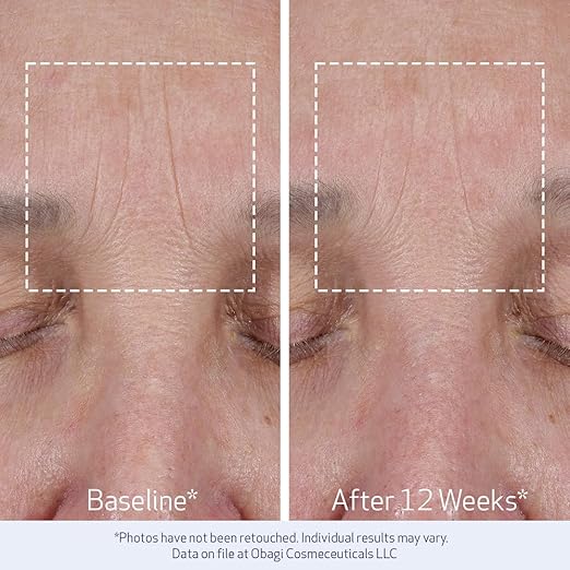 Obagi ELASTIderm Lift Up &amp Sculpt Facial Moisturizer ? Clinically Proven Anti-Aging Face Cream that Visibly Firms &amp Sculpts Facial Contours &amp Reduces Fine Lines &amp Wrinkles with Peptid