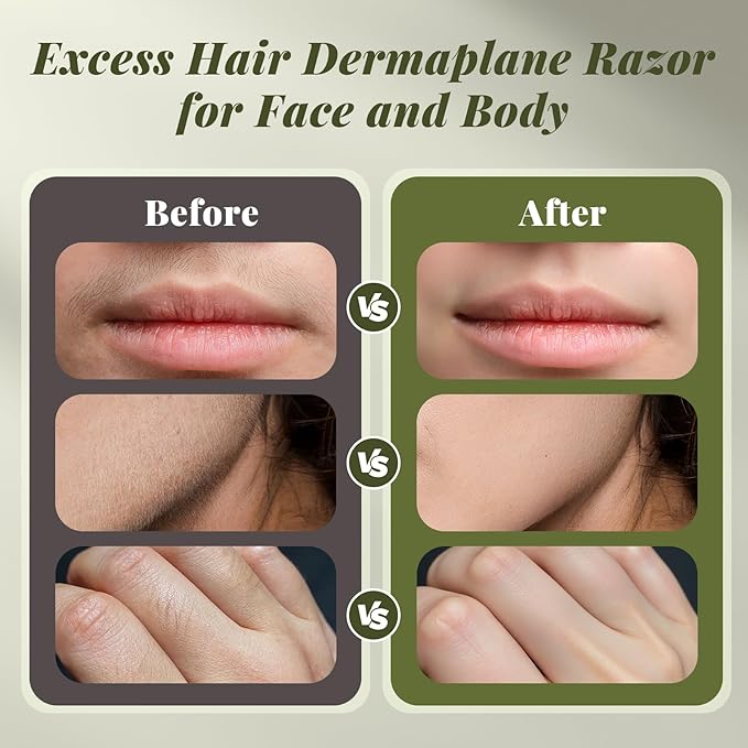 BNU Dermaplane Razor for Women Face Razor for Women with 10 Replaceable Blades - Face Exfoliation Razor - Body Peach Fuzz Removal - Eyebrow Shaper - Sonic Edge Technology Dermaplaning Tool - Green