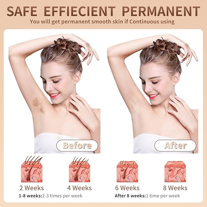 IPL Hair Removal Device for Women and MenPainless Home Use IPL Beauty Device For Home Use For Underarm facial hair below the chin line and legs.(Candy Pink/White 199 * 76.5 * 46.5mm)