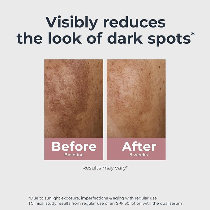 Eucerin Radiant Tone Dual Serum Dark Spot Corrector Dark Spot Serum with Thiamidol and Hyaluronic Acid Helps Visibly Reduce the Look of Dark Spots Holiday Gifts for Self Care 1 Fl Oz Bottle