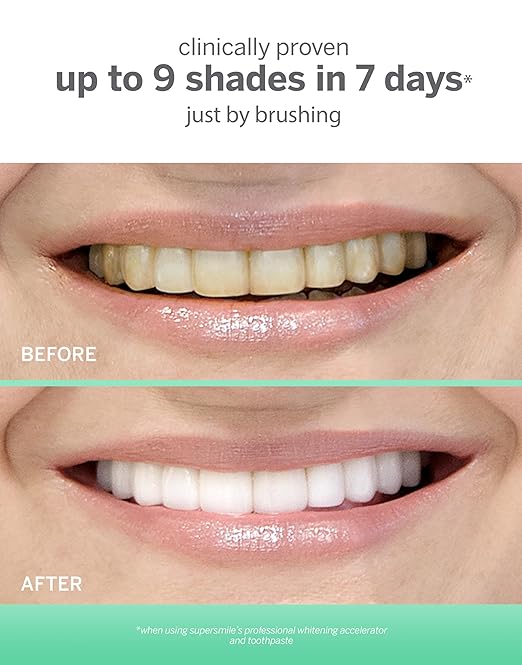 Supersmile Extra White Triple Mint Whitening Toothpaste ? Professional Formula for Visibly Whiter Teeth ? Whitens Up to 9 Shades 7 oz