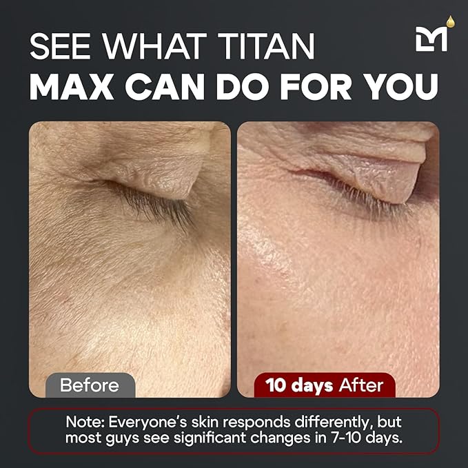 Titan MAX Anti-Aging Face Serum for Men ? Ultra Potency Mens Face Moisturizer ? Men Dark Spots Wrinkles Fine Lines ? Vitamin C &amp E 10% Niacinamide Hyaluronic Acid ? Unscented