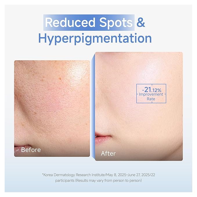 DAERA Synergy Boost Ampoule - Brightening Face Serum &amp Dark Spot Correcting Ampoule with Calcium Up+ Complex Anti-Aging Serum Fades Wrinkles Korean Skincare for Glowing Skin 30ml