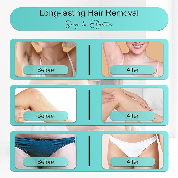 Professional IPL Laser Hair Removal Device &amp Epilator for Women and Men 999999 Flashes Permanent Hair Reduction for Face Legs Arms Bikini Line &amp Body Painless Treatments for Smooth Skin