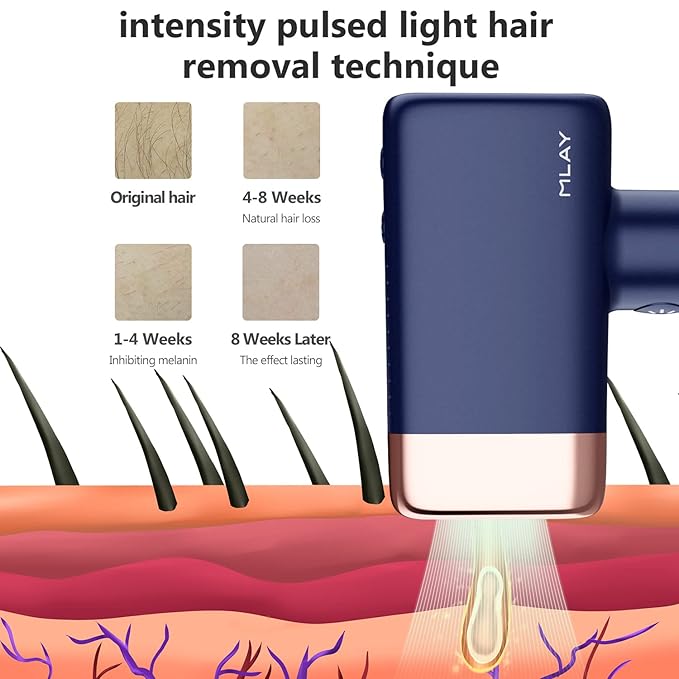 MLAY IPL Hair Removal Device Ice Cooling Protection Laser Permanent Whole Body Hair Remover for Home Use Women and Men (Bule)