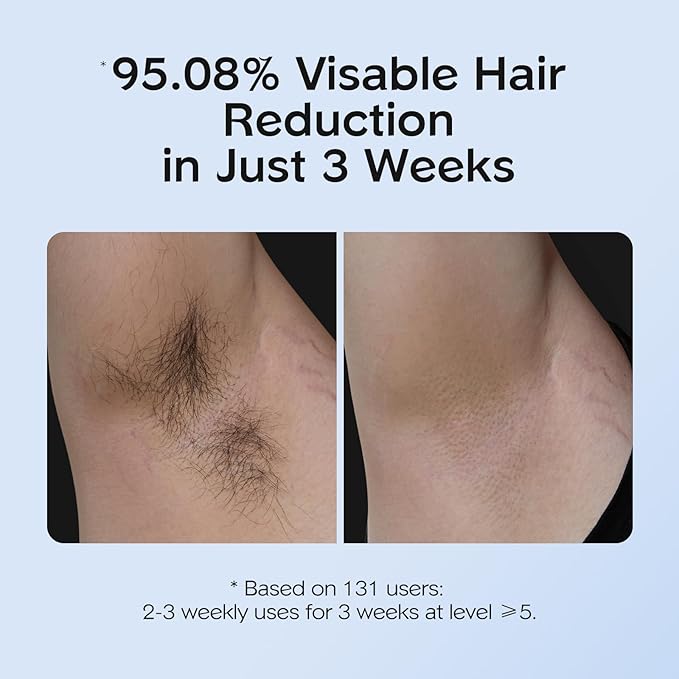 INNZA IPL Hair Removal with Ice Cooling Care Function for WomenLong-Lasting Results999999 Flashes Painless Hair Removal Hair Removal Device for Armpits Legs Arms Bikini Line