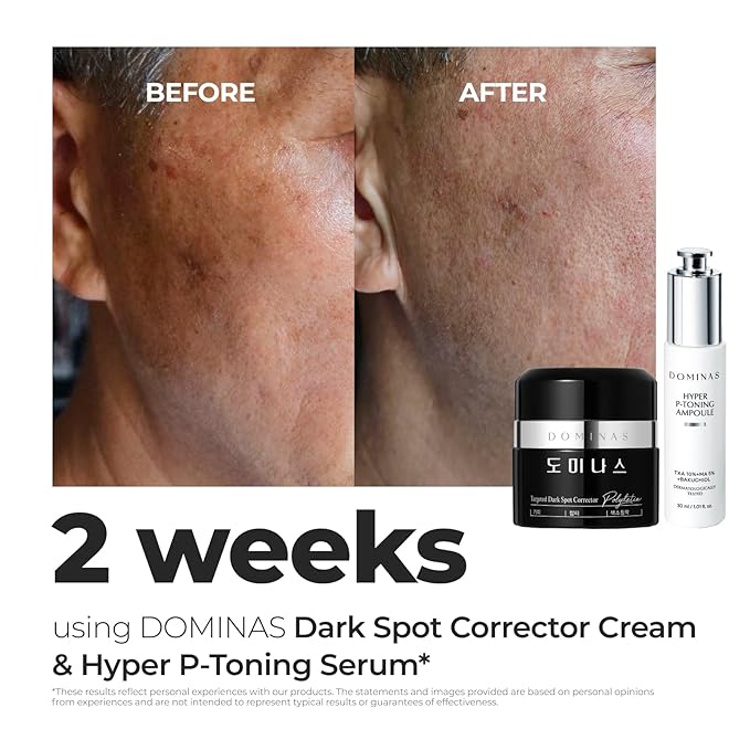 DOMINAS Dark Spot Corrector Cream | Advanced Formula with Niacinamide TXA Hexylresorcinol &amp Bakuchiol to Visibly Reduce Age Spots Sun Spots &amp Uneven Tone | Korean Skincare (1.76 oz)